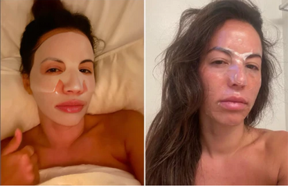 BioCollagenPlus – Máscara Absorbible de Colágeno + Activos de Botox